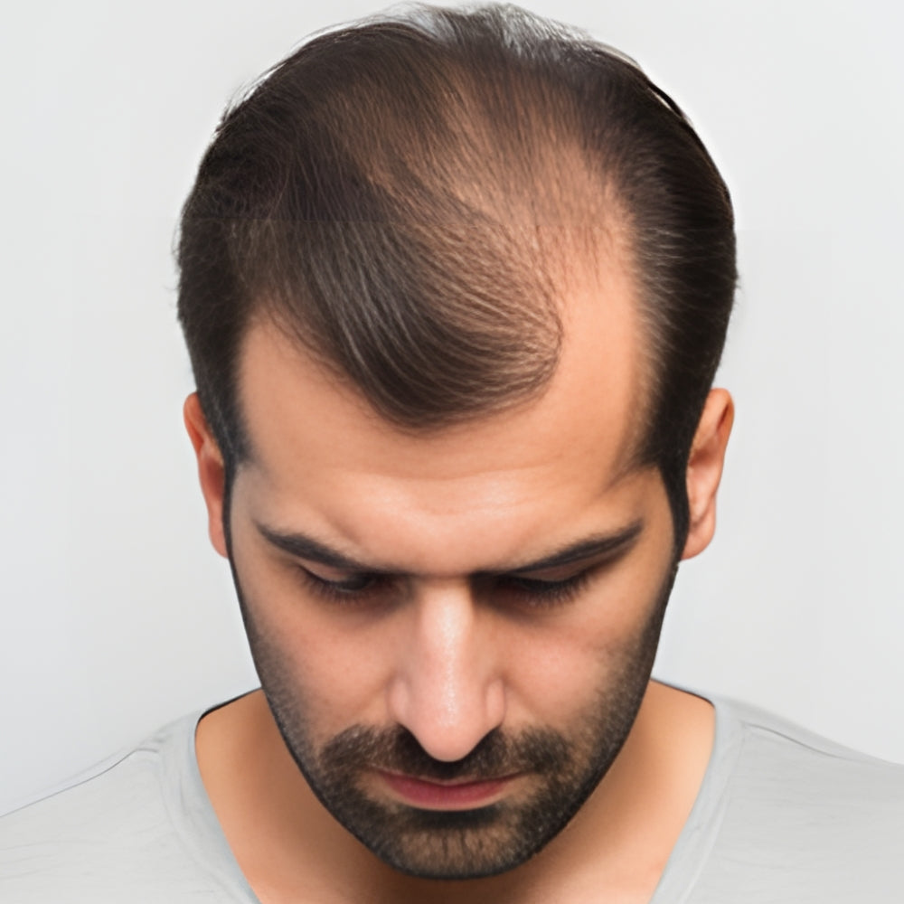 image comparison before