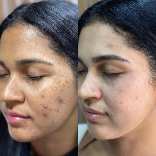 before and after