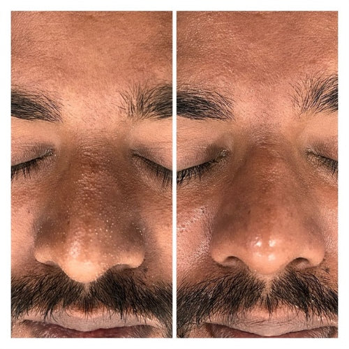before and after