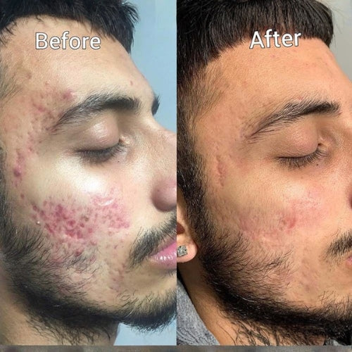 before and after