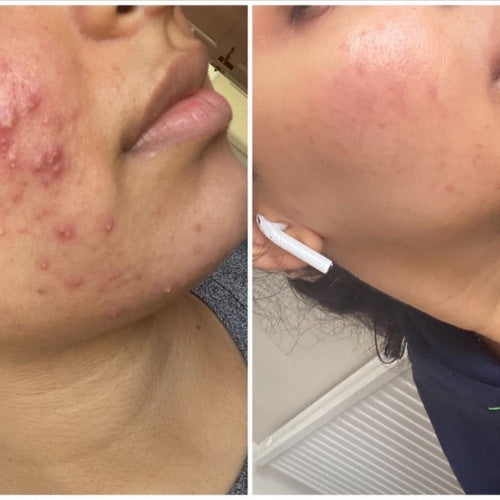 before and after