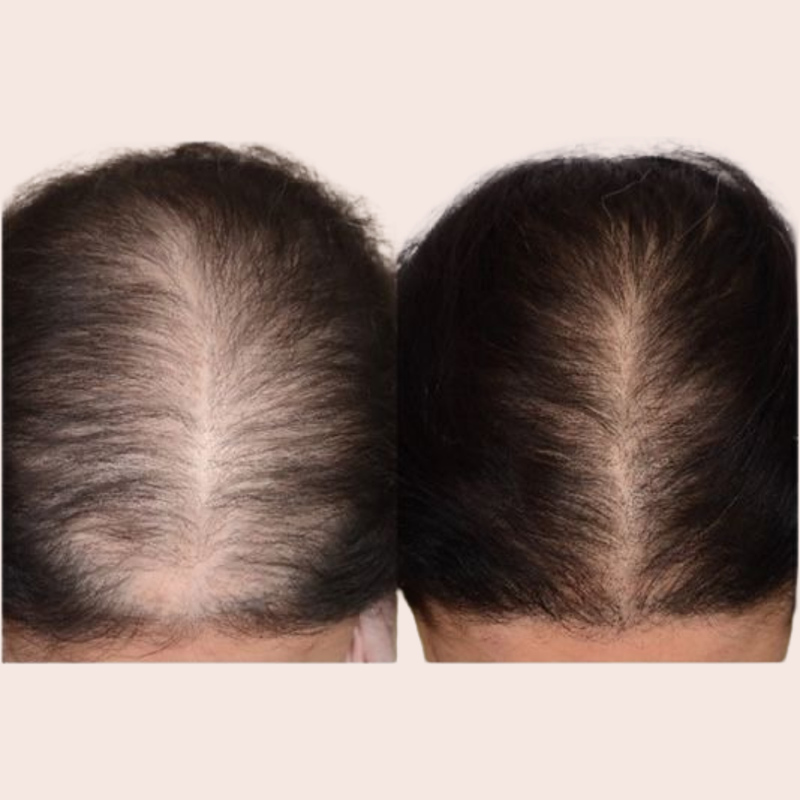 before and after
