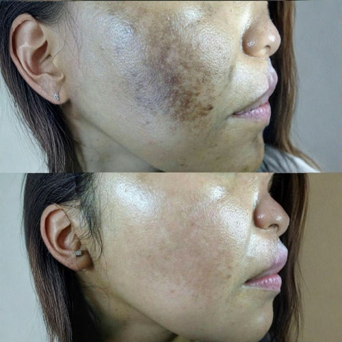before and after