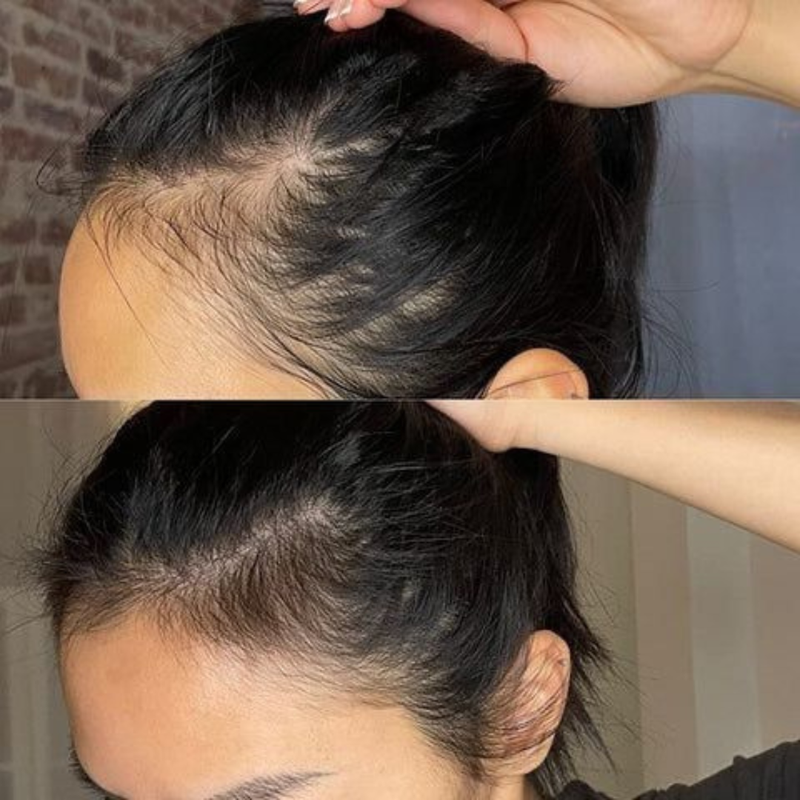 before and after